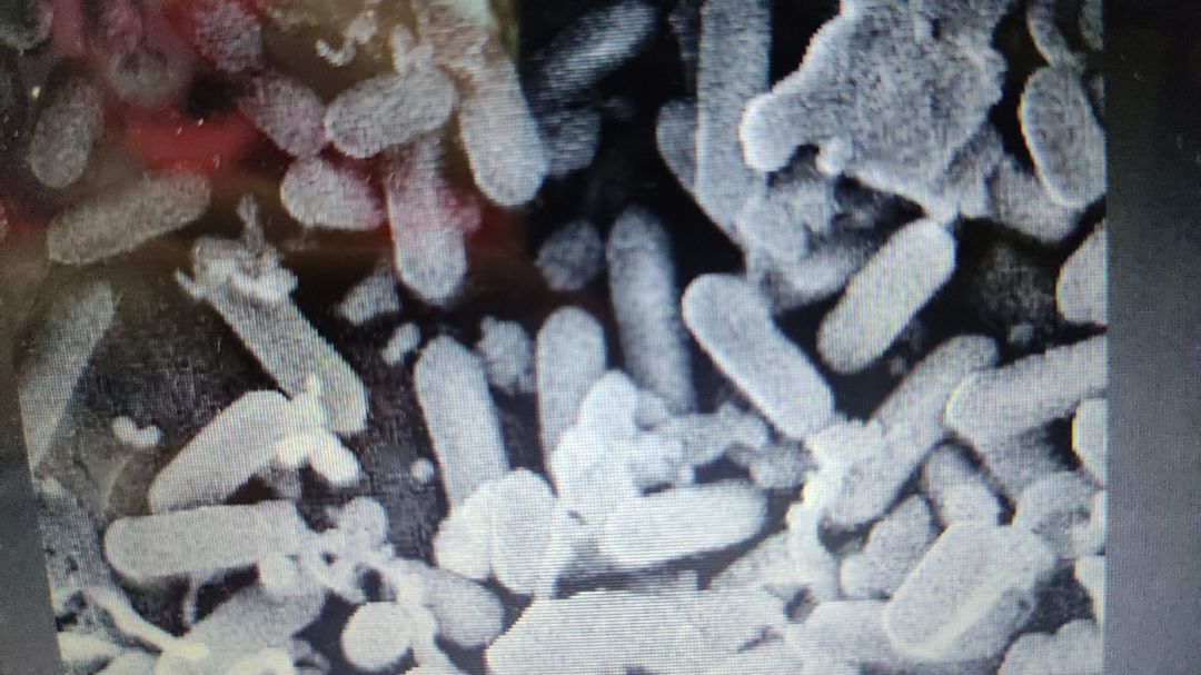 Imagen microscópica de bacterias del género Listeria Imagen microscópica de bacterias del género Listeria