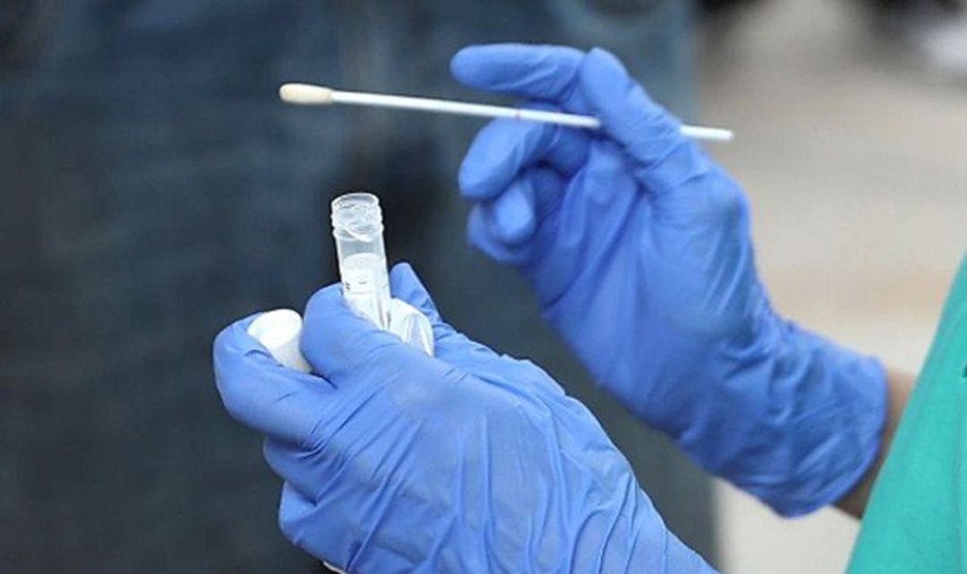 Una prueba PCR. Una prueba PCR.
