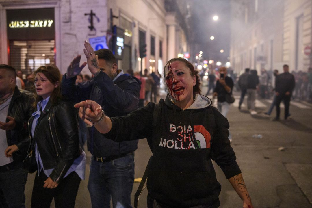 Una joven herida durante los altercados de este fin de semana. Una joven herida durante los altercados de este fin de semana.