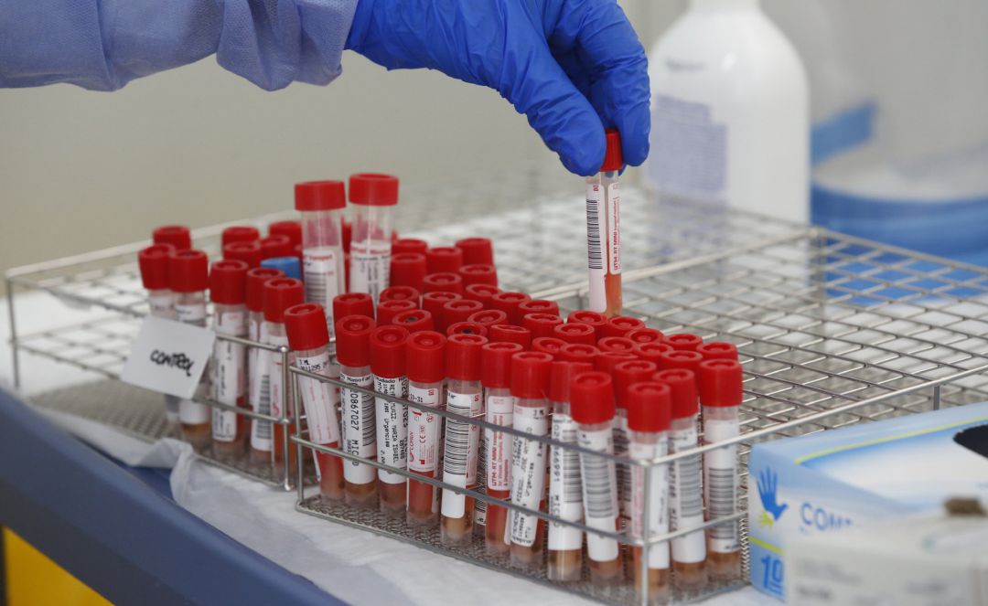 Tubos de pruebas PCR para la detección del COVID-19. Tubos de pruebas PCR para la detección del COVID-19.