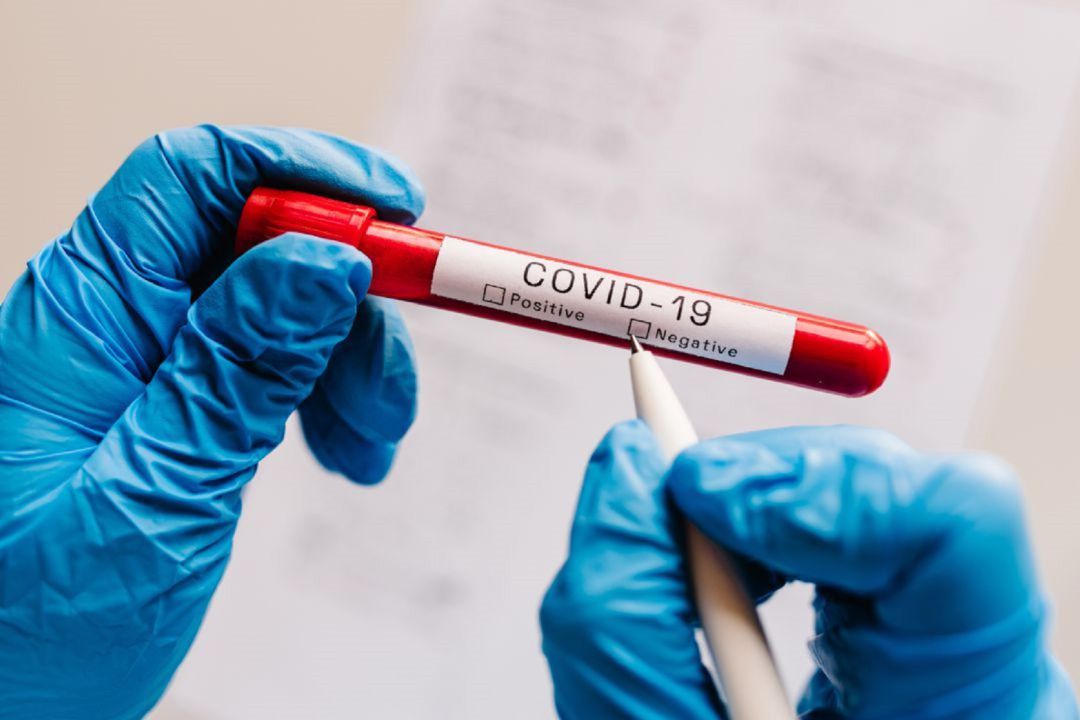Prueba de coronavirus Prueba de coronavirus