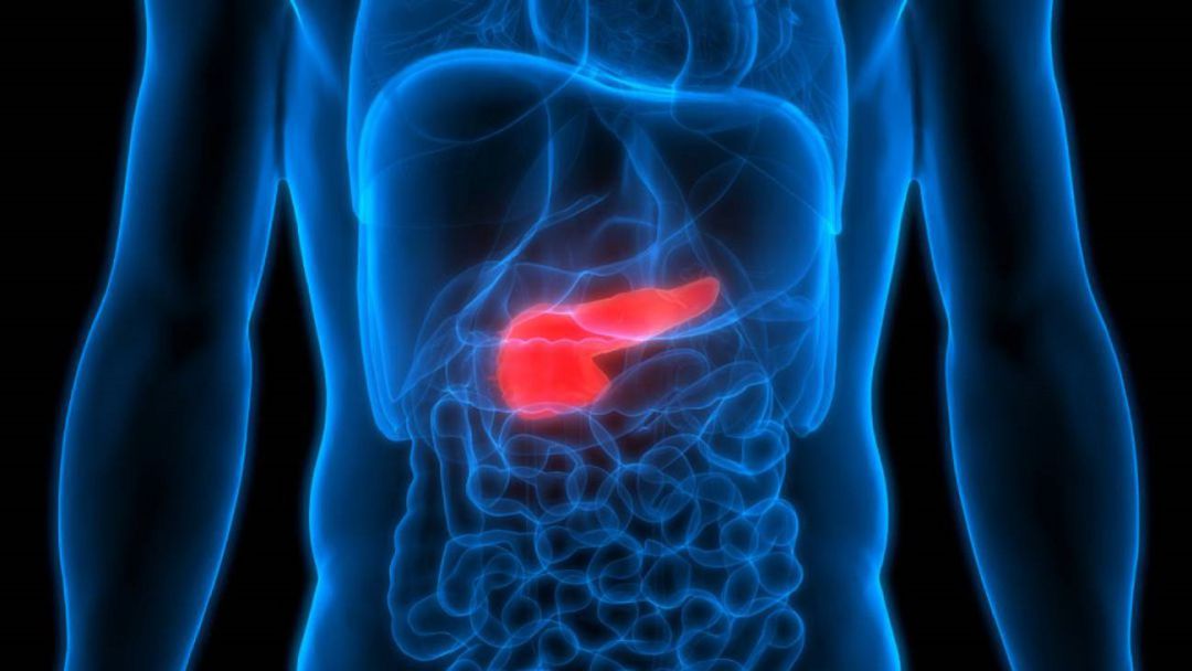 El Instituto de Investigación Sanitaria de Aragón trabaja para acabar con las células que originan el cáncer de páncreas. El Instituto de Investigación Sanitaria de Aragón trabaja para acabar con las células que originan el cáncer de páncreas.