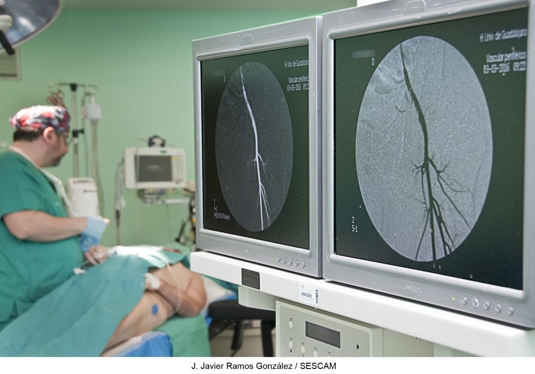 Intervención de cirugía vascular Intervención de cirugía vascular