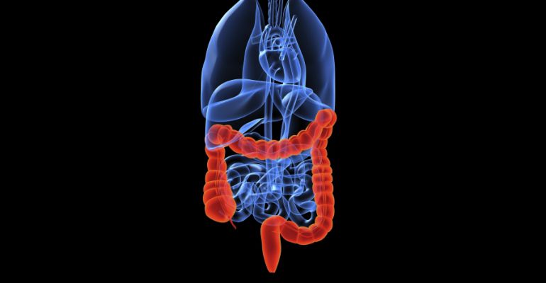 Metastasis colon esperanza de vida