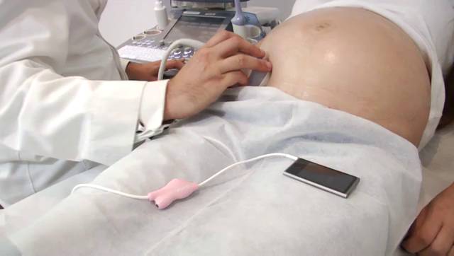 feto a las 16 semanas de gestacion