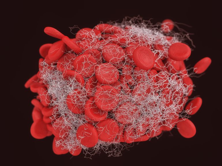 tratamiento del dolor para las células de cáncer de próstata