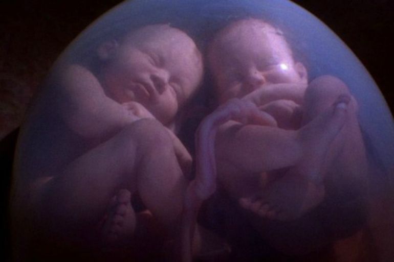 España es el tercer país del mundo en nacimientos de mellizos y gemelos