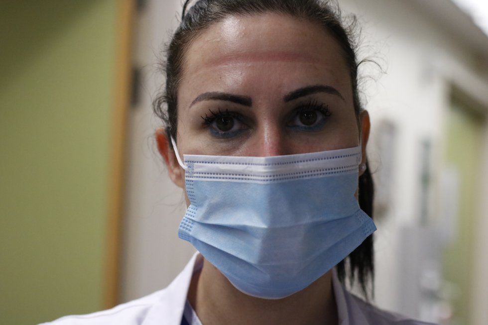 Las marcas de las gafas de protección de una sanitaria Las marcas de las gafas de protección de una sanitaria