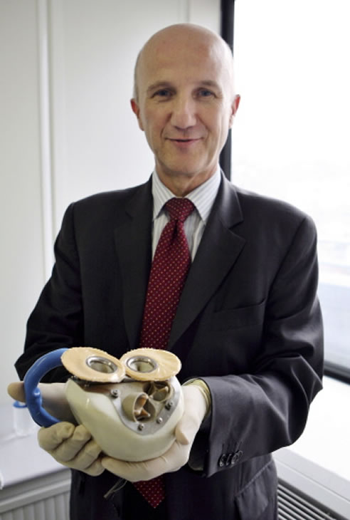 Patrick Coulombier, CEO de la empresa Carmat Biomédica, presenta el corazón implantable desarrollado por un equipo francés