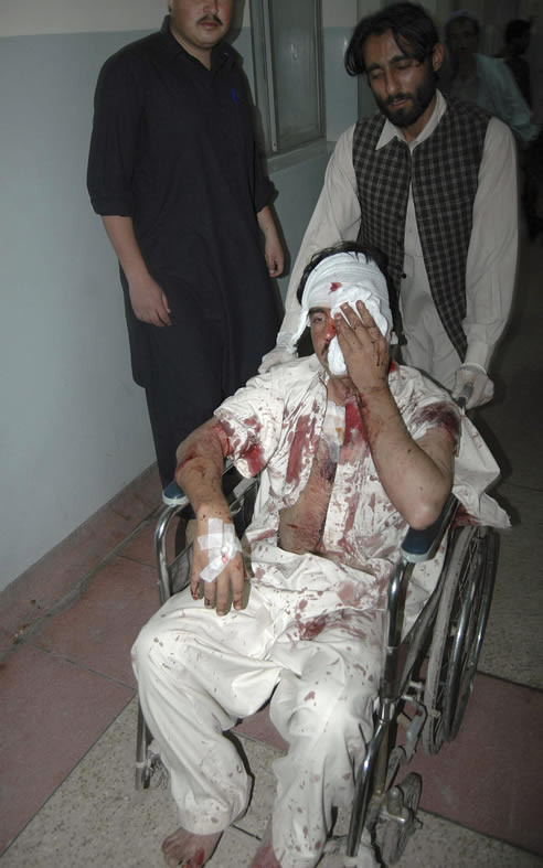 En la imagen, uno de los heridos es atendido en un centro hospitalario.
