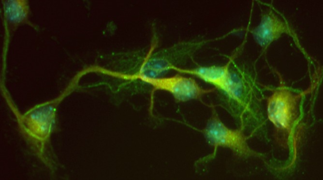 Un grupo de neuronas de un cerebro humano