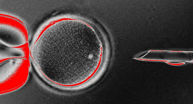 Imagen de la extracción del núcleo de un óvulo