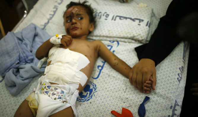 Una niña palestina yace en la cama de un hospital en la ciudad de Gaza