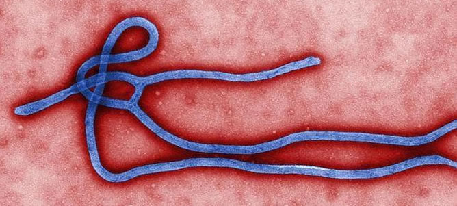 El virus del ébola.
