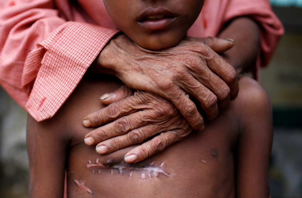 Los rohingya huyen de una ola de violencia que se desató a mediados de agosto en el estado de Rakhine, en Myanmar. "Estaban expuestos a violencia y a peligro, cuentan historias y testimonios de pueblos quemados, heridos, violaciones... Traen con ellos historias complicadas y duras", explica María Simón, coordinadora de emergencias de Médicos Sin Fronteras en Bangladesh. En la foto, Mohamed Taher, 50, rodea con sus brazos a su hijo Mohammed Shoaib, de 7 años, que fue disparado en el pecho antes de cruzar la frontera desde Myanmar. Los rohingya huyen de una ola de violencia que se desató a mediados de agosto en el estado de Rakhine, en Myanmar. "Estaban expuestos a violencia y a peligro, cuentan historias y testimonios de pueblos quemados, heridos, violaciones... Traen con ellos historias complicadas y duras", explica María Simón, coordinadora de emergencias de Médicos Sin Fronteras en Bangladesh. En la foto, Mohamed Taher, 50, rodea con sus brazos a su hijo Mohammed Shoaib, de 7 años, que fue disparado en el pecho antes de cruzar la frontera desde Myanmar.