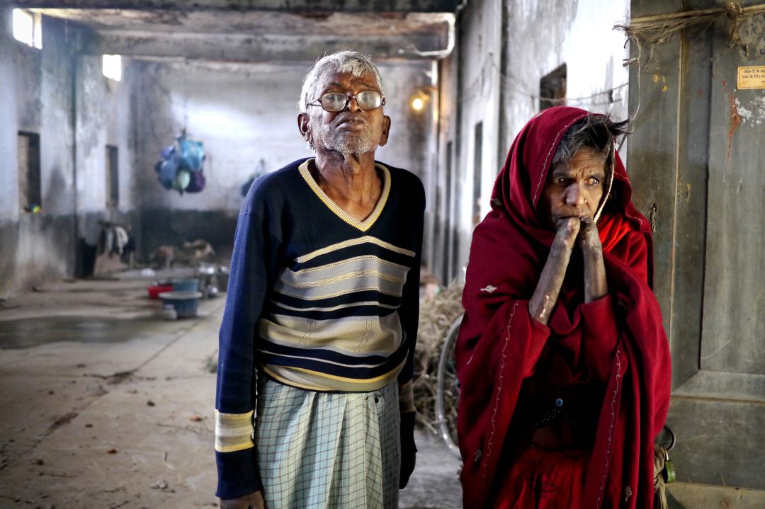 Enfermos de lepra en la India