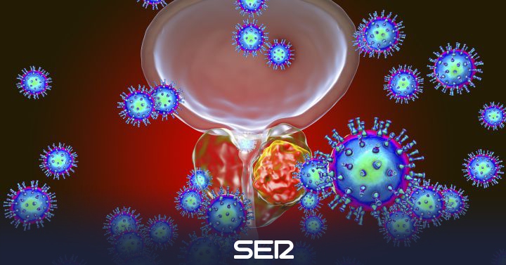 con cáncer de próstata, la testosterona debe ser baja con cáncer de próstata, la testosterona debe ser baja