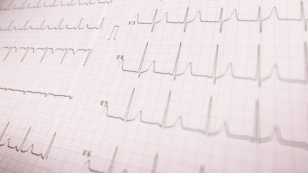 Las palabras más largas del diccionario