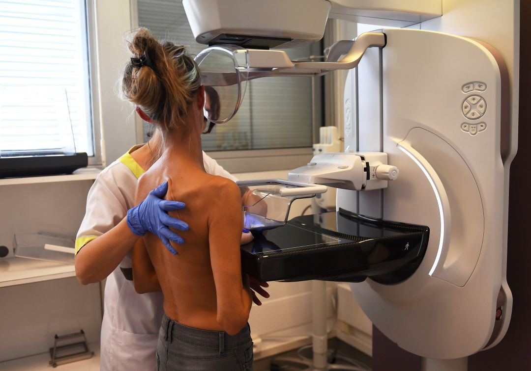 La mamografía es la técnica más eficaz para el detección precoz del cáncer de mama