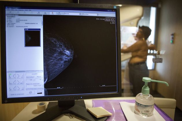 Las mamografías han demostrado su efectividadentre los 50 años y los 69 años