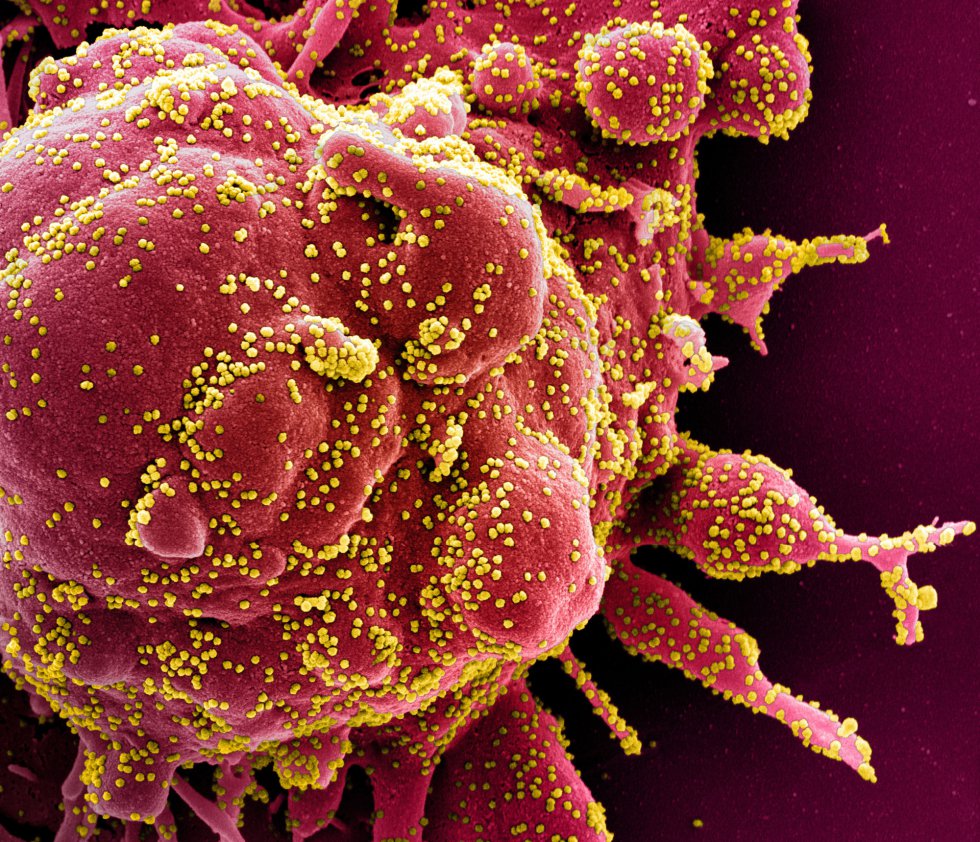 Fotos Reales Del Coronavirus Bajo El Microscopio Fotogaleria