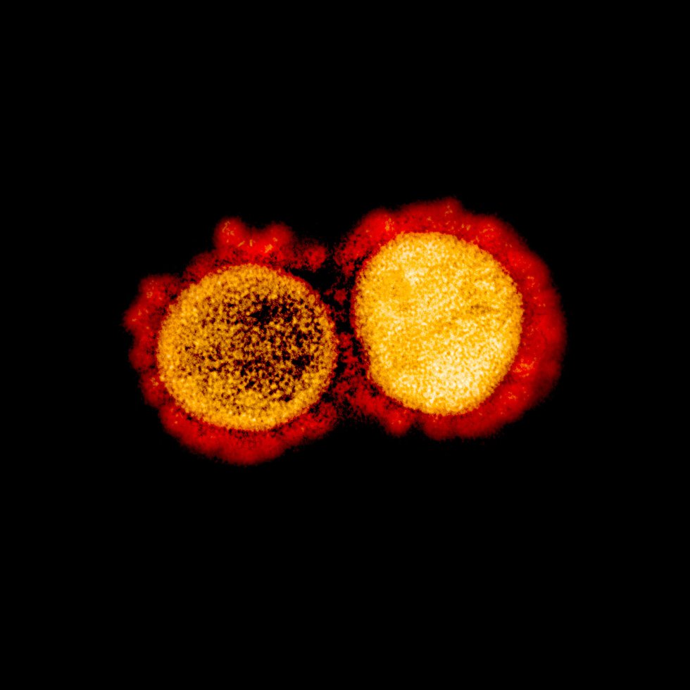 Transmisión de partículas del virus SARS-CoV-2, aislada de un paciente. Transmisión de partículas del virus SARS-CoV-2, aislada de un paciente.