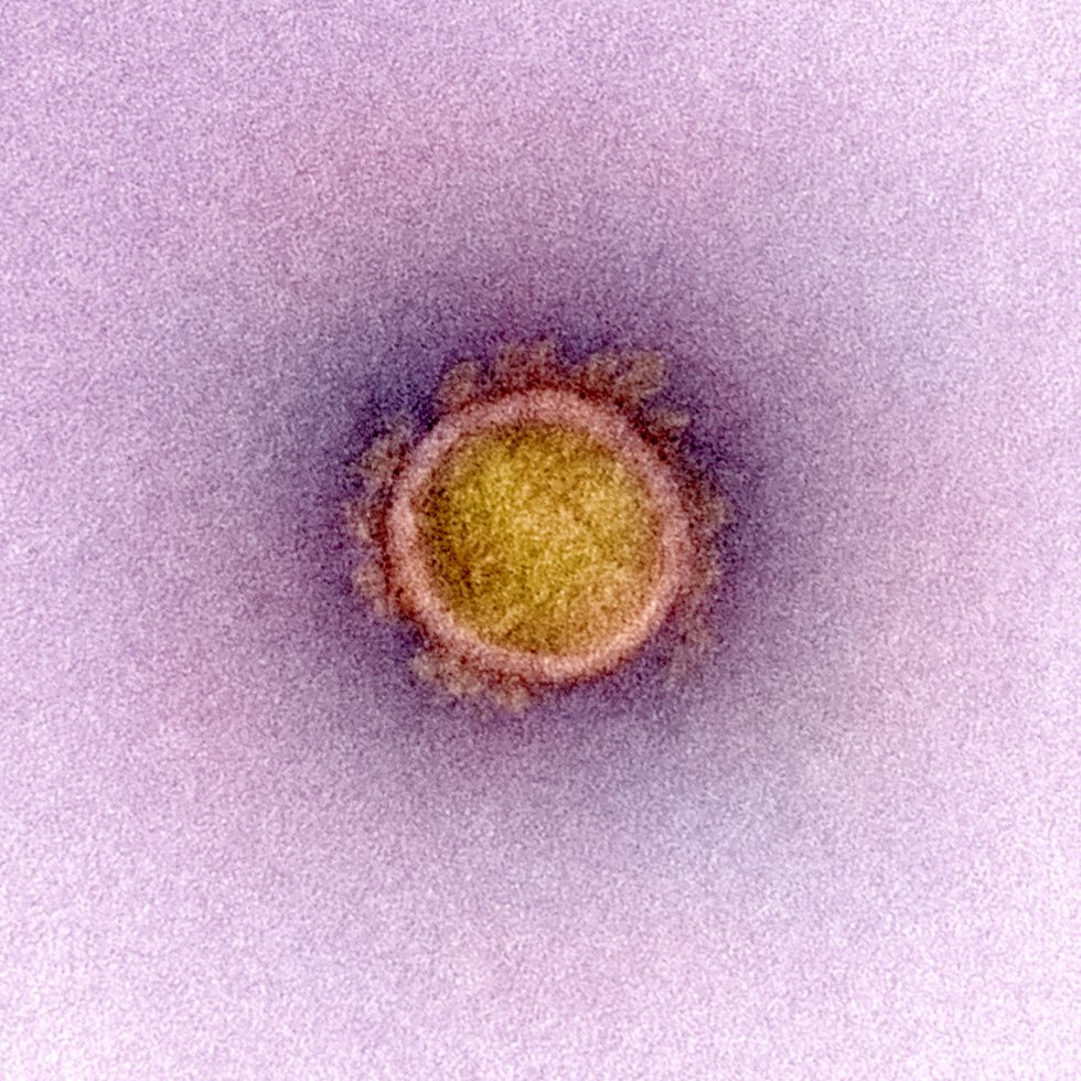 Transmisión de partículas del virus SARS-CoV-2, aislada de un paciente y con realce del color. Transmisión de partículas del virus SARS-CoV-2, aislada de un paciente y con realce del color.