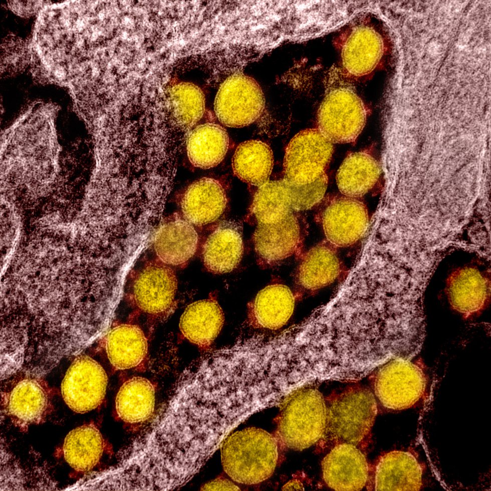 Transmisión de partículas de partículas del virus SARS-CoV-2, Transmisión de partículas de partículas del virus SARS-CoV-2,