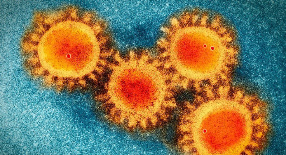 Foto de microscopio electrónico del coronavirus SARS-CoV-2, que causa la Covid-19 Foto de microscopio electrónico del coronavirus SARS-CoV-2, que causa la Covid-19