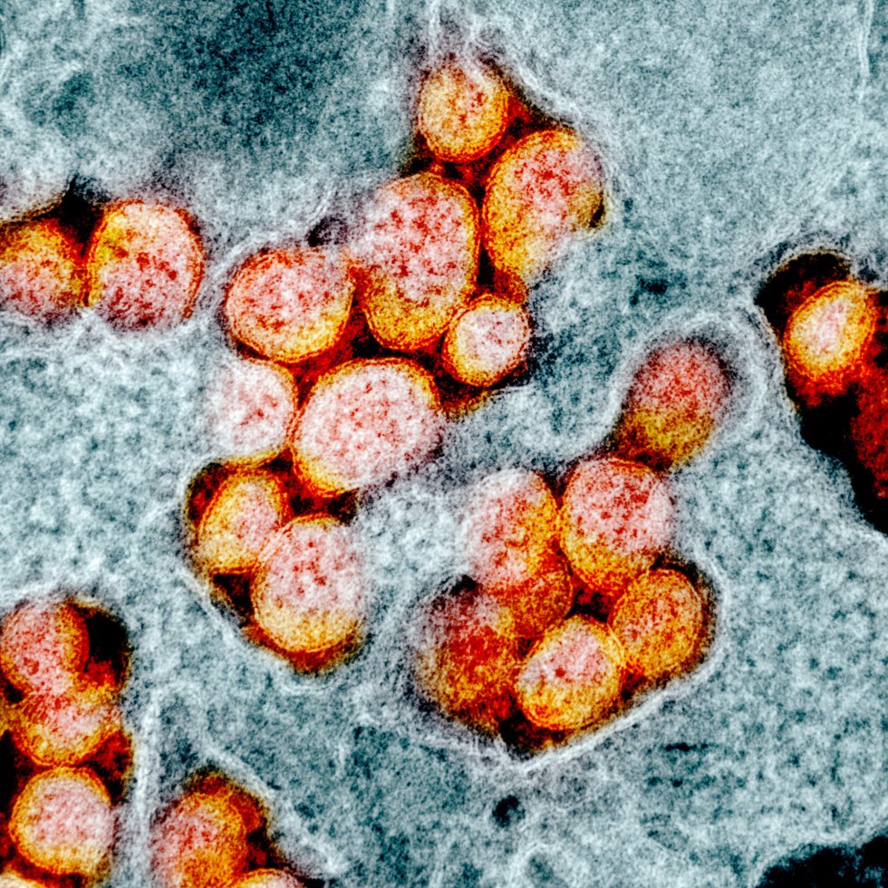 Micrografía electrónica de transmisión de partículas del virus SARS-CoV-2. Micrografía electrónica de transmisión de partículas del virus SARS-CoV-2.