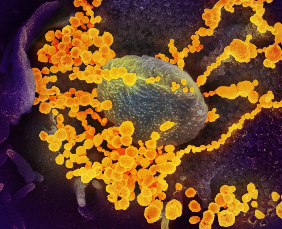 Esta imagen de microscopio electrónico del Instituto estadounidense de Alergia y Enfermedades Infecciosas (NIAID), coloreada digitalmente, muestra el SARS-CoV-2, también conocido como 2019-nCoV, el virus que causa COVID-19, aislado de un paciente de EE.UU., mientras las partículas de virus (con forma redonda y color amarillo) emergen de la superficie de las células cultivadas en laboratorio en Hamilton / Montana (Estados Unidos de América), a 13 de febrero de 2020.
CORONAVIRUS;COVID-19;ESTADO DE ALARMA;PANDEMIA;LABORATORIO;NIAID;
NIAID-RML (Foto de ARCHIVO)
13/02/2020 Esta imagen de microscopio electrónico del Instituto estadounidense de Alergia y Enfermedades Infecciosas (NIAID), coloreada digitalmente, muestra el SARS-CoV-2, también conocido como 2019-nCoV, el virus que causa COVID-19, aislado de un paciente de EE.UU., mientras las partículas de virus (con forma redonda y color amarillo) emergen de la superficie de las células cultivadas en laboratorio en Hamilton / Montana (Estados Unidos de América), a 13 de febrero de 2020.
CORONAVIRUS;COVID-19;ESTADO DE ALARMA;PANDEMIA;LABORATORIO;NIAID;
NIAID-RML (Foto de ARCHIVO)
13/02/2020