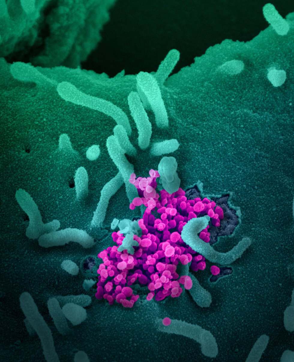Esta imagen de microscopio electrónico del Instituto estadounidense de Alergia y Enfermedades Infecciosas (NIAID), coloreada digitalmente, muestra el SARS-CoV-2, también conocido como 2019-nCoV, el virus que causa COVID-19, aislado de un paciente de EE.UU., mientras las partículas de virus (con forma redonda y color magenta) emergen de la superficie de las células cultivadas en laboratorio en Hamilton / Montana (Estados Unidos de América), a 13 de febrero de 2020.
CORONAVIRUS;COVID-19;ESTADO DE ALARMA;PANDEMIA;LABORATORIO;NIAID;
NIAID-RML (Foto de ARCHIVO)
13/02/2020 Esta imagen de microscopio electrónico del Instituto estadounidense de Alergia y Enfermedades Infecciosas (NIAID), coloreada digitalmente, muestra el SARS-CoV-2, también conocido como 2019-nCoV, el virus que causa COVID-19, aislado de un paciente de EE.UU., mientras las partículas de virus (con forma redonda y color magenta) emergen de la superficie de las células cultivadas en laboratorio en Hamilton / Montana (Estados Unidos de América), a 13 de febrero de 2020.
CORONAVIRUS;COVID-19;ESTADO DE ALARMA;PANDEMIA;LABORATORIO;NIAID;
NIAID-RML (Foto de ARCHIVO)
13/02/2020
