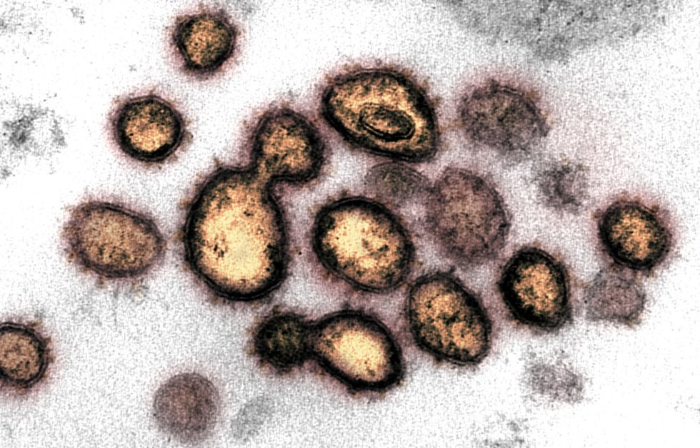 Esta imagen de microscopio electrónico del Instituto estadounidense de Alergia y Enfermedades Infecciosas (NIAID), coloreada digitalmente, muestra el SARS-CoV-2, también conocido como 2019-nCoV, el virus que causa COVID-19, aislado de un paciente de EE.UU., mientras las partículas de virus emergen de la superficie de las células cultivadas en laboratorio y se aprecian los picos en los bordes que le dan nombre por su forma de corona, en Hamilton / Montana (Estados Unidos de América), a 13 de febrero de 2020.
CORONAVIRUS;COVID-19;ESTADO DE ALARMA;PANDEMIA;LABORATORIO;NIAID;
NIAID-RML (Foto de ARCHIVO)
13/02/2020 Esta imagen de microscopio electrónico del Instituto estadounidense de Alergia y Enfermedades Infecciosas (NIAID), coloreada digitalmente, muestra el SARS-CoV-2, también conocido como 2019-nCoV, el virus que causa COVID-19, aislado de un paciente de EE.UU., mientras las partículas de virus emergen de la superficie de las células cultivadas en laboratorio y se aprecian los picos en los bordes que le dan nombre por su forma de corona, en Hamilton / Montana (Estados Unidos de América), a 13 de febrero de 2020.
CORONAVIRUS;COVID-19;ESTADO DE ALARMA;PANDEMIA;LABORATORIO;NIAID;
NIAID-RML (Foto de ARCHIVO)
13/02/2020