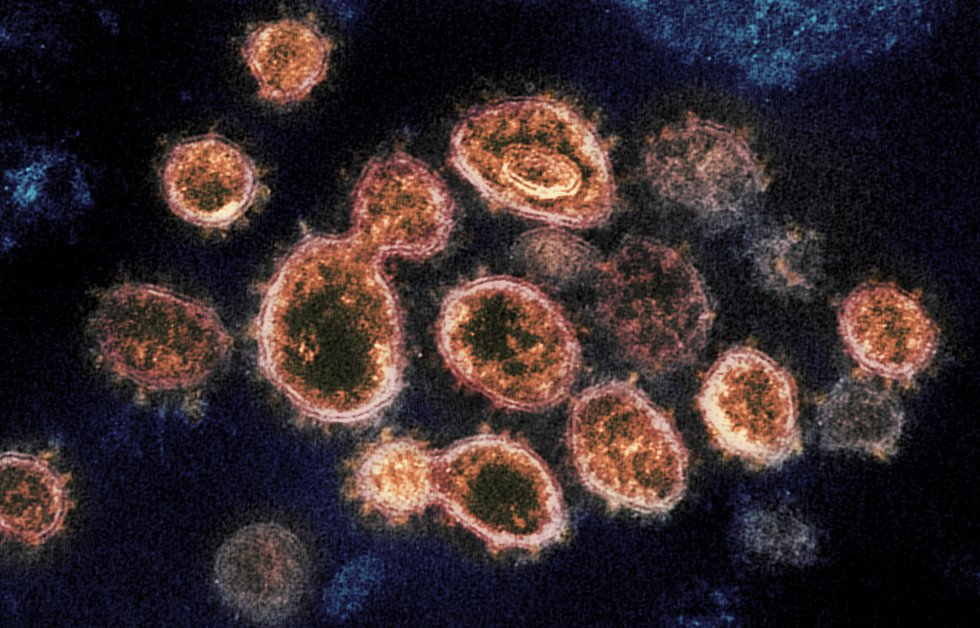 Esta imagen de microscopio electrónico del Instituto estadounidense de Alergia y Enfermedades Infecciosas (NIAID), coloreada digitalmente, muestra el SARS-CoV-2, también conocido como 2019-nCoV, el virus que causa COVID-19, aislado de un paciente de EE.UU., mientras las partículas de virus emergen de la superficie de las células cultivadas en laboratorio y se aprecian los picos en los bordes que le dan nombre por su forma de corona en Hamilton / Montana (Estados Unidos de América), a 13 de febrero de 2020.
CORONAVIRUS;COVID-19;ESTADO DE ALARMA;PANDEMIA;LABORATORIO;NIAID;
NIAID-RML (Foto de ARCHIVO)
13/02/2020 Esta imagen de microscopio electrónico del Instituto estadounidense de Alergia y Enfermedades Infecciosas (NIAID), coloreada digitalmente, muestra el SARS-CoV-2, también conocido como 2019-nCoV, el virus que causa COVID-19, aislado de un paciente de EE.UU., mientras las partículas de virus emergen de la superficie de las células cultivadas en laboratorio y se aprecian los picos en los bordes que le dan nombre por su forma de corona en Hamilton / Montana (Estados Unidos de América), a 13 de febrero de 2020.
CORONAVIRUS;COVID-19;ESTADO DE ALARMA;PANDEMIA;LABORATORIO;NIAID;
NIAID-RML (Foto de ARCHIVO)
13/02/2020