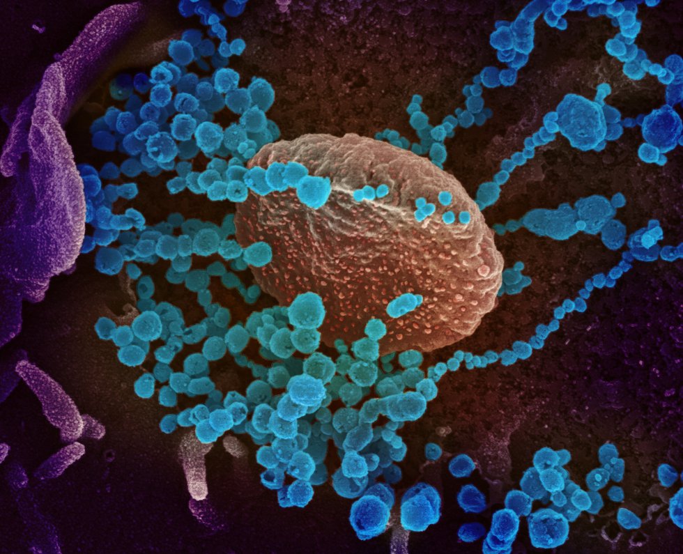 Esta imagen de microscopio electrónico del Instituto estadounidense de Alergia y Enfermedades Infecciosas (NIAID), coloreada digitalmente, muestra el SARS-CoV-2, con forma redonda y azul en la imagen, también conocido como 2019-nCoV, el virus que causa COVID-19, aislado de un paciente de EE.UU., mientras las partículas de virus emergen de la superficie de las células cultivadas en laboratorio en Hamilton / Montana (Estados Unidos de América), a 13 de febrero de 2020.
CORONAVIRUS;COVID-19;ESTADO DE ALARMA;PANDEMIA;LABORATORIO;NIAID;
NIAID-RML (Foto de ARCHIVO)
13/02/2020 Esta imagen de microscopio electrónico del Instituto estadounidense de Alergia y Enfermedades Infecciosas (NIAID), coloreada digitalmente, muestra el SARS-CoV-2, con forma redonda y azul en la imagen, también conocido como 2019-nCoV, el virus que causa COVID-19, aislado de un paciente de EE.UU., mientras las partículas de virus emergen de la superficie de las células cultivadas en laboratorio en Hamilton / Montana (Estados Unidos de América), a 13 de febrero de 2020.
CORONAVIRUS;COVID-19;ESTADO DE ALARMA;PANDEMIA;LABORATORIO;NIAID;
NIAID-RML (Foto de ARCHIVO)
13/02/2020