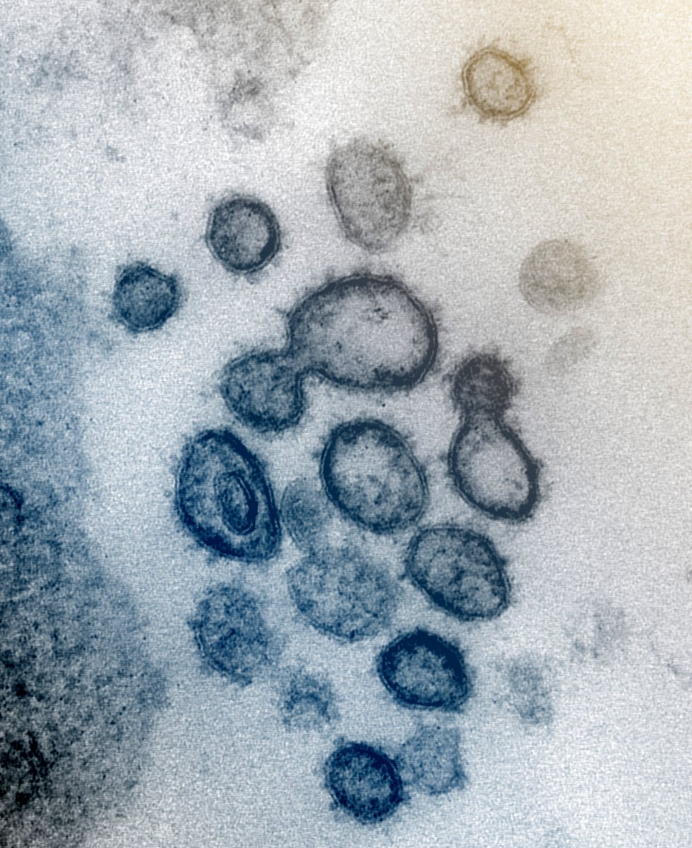 Esta imagen de microscopio electrónico del Instituto estadounidense de Alergia y Enfermedades Infecciosas (NIAID), coloreada digitalmente, muestra el SARS-CoV-2, también conocido como 2019-nCoV, el virus que causa COVID-19, aislado de un paciente de EE.UU., mientras las partículas de virus emergen de la superficie de las células cultivadas en laboratorio y se aprecian los picos en el borde exterior, que dan a los coronavirus su nombre por su forma de corona, en Hamilton / Montana (Estados Unidos de América), a 13 de febrero de 2020.
CORONAVIRUS;COVID-19;ESTADO DE ALARMA;PANDEMIA;LABORATORIO;NIAID;
NIAID-RML (Foto de ARCHIVO)
13/02/2020 Esta imagen de microscopio electrónico del Instituto estadounidense de Alergia y Enfermedades Infecciosas (NIAID), coloreada digitalmente, muestra el SARS-CoV-2, también conocido como 2019-nCoV, el virus que causa COVID-19, aislado de un paciente de EE.UU., mientras las partículas de virus emergen de la superficie de las células cultivadas en laboratorio y se aprecian los picos en el borde exterior, que dan a los coronavirus su nombre por su forma de corona, en Hamilton / Montana (Estados Unidos de América), a 13 de febrero de 2020.
CORONAVIRUS;COVID-19;ESTADO DE ALARMA;PANDEMIA;LABORATORIO;NIAID;
NIAID-RML (Foto de ARCHIVO)
13/02/2020