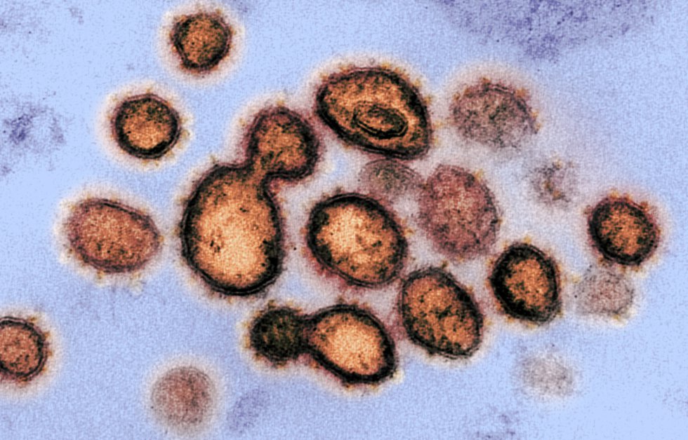 Esta imagen de microscopio electrónico del Instituto estadounidense de Alergia y Enfermedades Infecciosas (NIAID), coloreada digitalmente, muestra el SARS-CoV-2, también conocido como 2019-nCoV, el virus que causa COVID-19, aislado de un paciente de EE.UU., mientras las partículas de virus emergen de la superficie de las células cultivadas en laboratorio y se aprecian los picos en el borde exterior, que dan a los coronavirus su nombre por su forma de corona, en Hamilton / Montana (Estados Unidos de América), a 13 de febrero de 2020.
CORONAVIRUS;COVID-19;ESTADO DE ALARMA;PANDEMIA;LABORATORIO;NIAID;
NIAID-RML (Foto de ARCHIVO)
13/02/2020 Esta imagen de microscopio electrónico del Instituto estadounidense de Alergia y Enfermedades Infecciosas (NIAID), coloreada digitalmente, muestra el SARS-CoV-2, también conocido como 2019-nCoV, el virus que causa COVID-19, aislado de un paciente de EE.UU., mientras las partículas de virus emergen de la superficie de las células cultivadas en laboratorio y se aprecian los picos en el borde exterior, que dan a los coronavirus su nombre por su forma de corona, en Hamilton / Montana (Estados Unidos de América), a 13 de febrero de 2020.
CORONAVIRUS;COVID-19;ESTADO DE ALARMA;PANDEMIA;LABORATORIO;NIAID;
NIAID-RML (Foto de ARCHIVO)
13/02/2020
