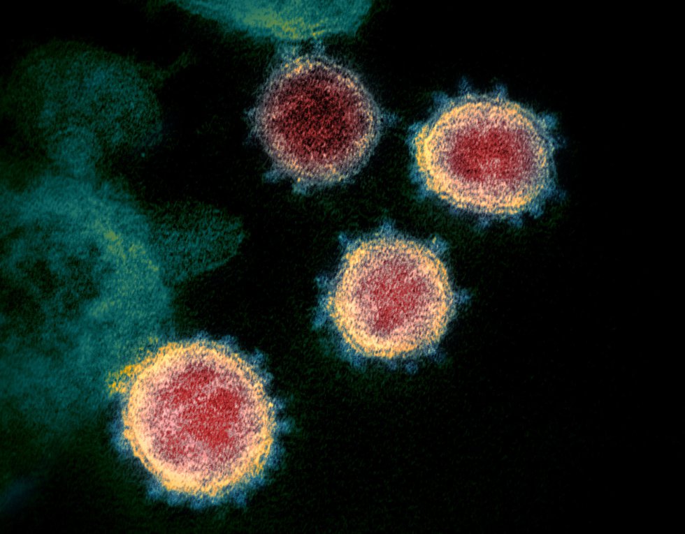 Esta imagen de microscopio electrónico del Instituto estadounidense de Alergia y Enfermedades Infecciosas (NIAID), coloreada digitalmente, muestra el SARS-CoV-2, también conocido como 2019-nCoV, el virus que causa COVID-19, aislado de un paciente de EE.UU., mientras las partículas de virus emergen de la superficie de las células cultivadas en laboratorio y se aprecian los picos en el borde exterior, que dan a los coronavirus su nombre por su forma de corona, en Hamilton / Montana (Estados Unidos de América), a 13 de febrero de 2020.
CORONAVIRUS;COVID-19;ESTADO DE ALARMA;PANDEMIA;LABORATORIO;NIAID;
NIAID-RML (Foto de ARCHIVO)
13/02/2020 Esta imagen de microscopio electrónico del Instituto estadounidense de Alergia y Enfermedades Infecciosas (NIAID), coloreada digitalmente, muestra el SARS-CoV-2, también conocido como 2019-nCoV, el virus que causa COVID-19, aislado de un paciente de EE.UU., mientras las partículas de virus emergen de la superficie de las células cultivadas en laboratorio y se aprecian los picos en el borde exterior, que dan a los coronavirus su nombre por su forma de corona, en Hamilton / Montana (Estados Unidos de América), a 13 de febrero de 2020.
CORONAVIRUS;COVID-19;ESTADO DE ALARMA;PANDEMIA;LABORATORIO;NIAID;
NIAID-RML (Foto de ARCHIVO)
13/02/2020