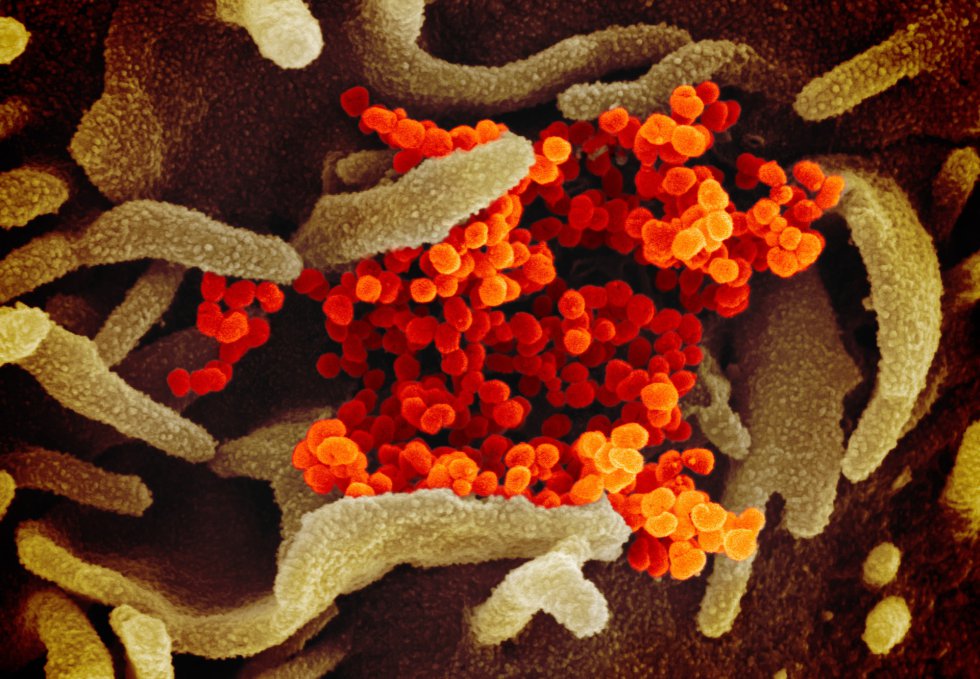 Esta imagen de microscopio electrónico del Instituto estadounidense de Alergia y Enfermedades Infecciosas (NIAID), coloreada digitalmente, muestra el SARS-CoV-2, también conocido como 2019-nCoV, el virus que causa COVID-19, aislado de un paciente de EE.UU., que emerge de la superficie de células cultivadas en laboratorio, de color verde, en Hamilton / Montana (Estados Unidos de América), a 13 de febrero de 2020.
CORONAVIRUS;COVID-19;ESTADO DE ALARMA;PANDEMIA;LABORATORIO;NIAID;
NIAID-RML (Foto de ARCHIVO)
13/02/2020 Esta imagen de microscopio electrónico del Instituto estadounidense de Alergia y Enfermedades Infecciosas (NIAID), coloreada digitalmente, muestra el SARS-CoV-2, también conocido como 2019-nCoV, el virus que causa COVID-19, aislado de un paciente de EE.UU., que emerge de la superficie de células cultivadas en laboratorio, de color verde, en Hamilton / Montana (Estados Unidos de América), a 13 de febrero de 2020.
CORONAVIRUS;COVID-19;ESTADO DE ALARMA;PANDEMIA;LABORATORIO;NIAID;
NIAID-RML (Foto de ARCHIVO)
13/02/2020