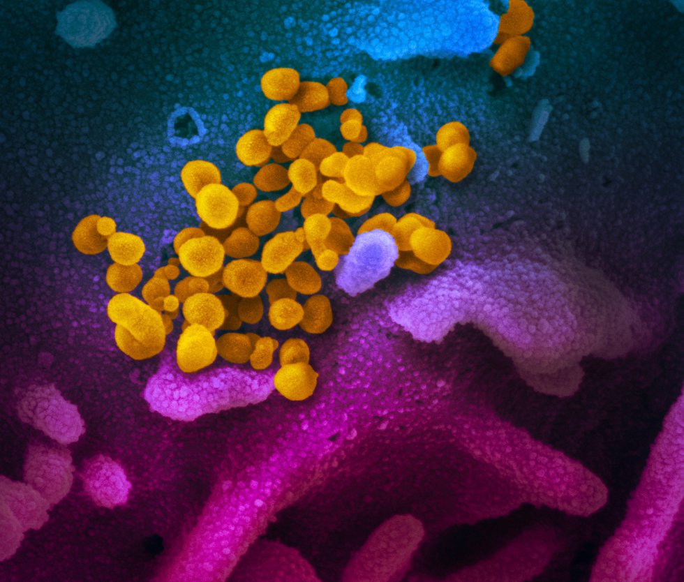 Esta imagen de microscopio electrónico del Instituto estadounidense de Alergia y Enfermedades Infecciosas (NIAID), coloreada digitalmente, muestra el SARS-CoV-2, también conocido como 2019-nCoV, el virus que causa COVID-19, aislado de un paciente de EE.UU., que emerge de la superficie de células cultivadas en laboratorio, de color rosa y azul, en Hamilton / Montana (Estados Unidos de América), a 13 de febrero de 2020.
CORONAVIRUS;COVID-19;ESTADO DE ALARMA;PANDEMIA;LABORATORIO;NIAID;
NIAID-RML
13/04/2020 Esta imagen de microscopio electrónico del Instituto estadounidense de Alergia y Enfermedades Infecciosas (NIAID), coloreada digitalmente, muestra el SARS-CoV-2, también conocido como 2019-nCoV, el virus que causa COVID-19, aislado de un paciente de EE.UU., que emerge de la superficie de células cultivadas en laboratorio, de color rosa y azul, en Hamilton / Montana (Estados Unidos de América), a 13 de febrero de 2020.
CORONAVIRUS;COVID-19;ESTADO DE ALARMA;PANDEMIA;LABORATORIO;NIAID;
NIAID-RML
13/04/2020