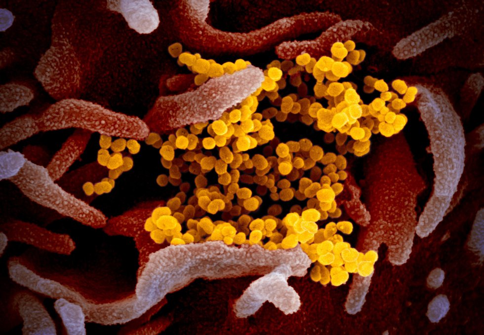Esta imagen de microscopio electrónico del Instituto estadounidense de Alergia y Enfermedades Infecciosas (NIAID) muestra el SARS-CoV-2, también conocido como 2019-nCoV, el virus que causa COVID-19, aislado de un paciente de EE.UU., que emerge de la superficie de células cultivadas en laboratorio, de color rosa, en Hamilton / Montana (Estados Unidos de América), a 13 de febrero de 2020.
CORONAVIRUS;COVID-19;ESTADO DE ALARMA;PANDEMIA;LABORATORIO;NIAID;
NIAID-RML
13/04/2020 Esta imagen de microscopio electrónico del Instituto estadounidense de Alergia y Enfermedades Infecciosas (NIAID) muestra el SARS-CoV-2, también conocido como 2019-nCoV, el virus que causa COVID-19, aislado de un paciente de EE.UU., que emerge de la superficie de células cultivadas en laboratorio, de color rosa, en Hamilton / Montana (Estados Unidos de América), a 13 de febrero de 2020.
CORONAVIRUS;COVID-19;ESTADO DE ALARMA;PANDEMIA;LABORATORIO;NIAID;
NIAID-RML
13/04/2020