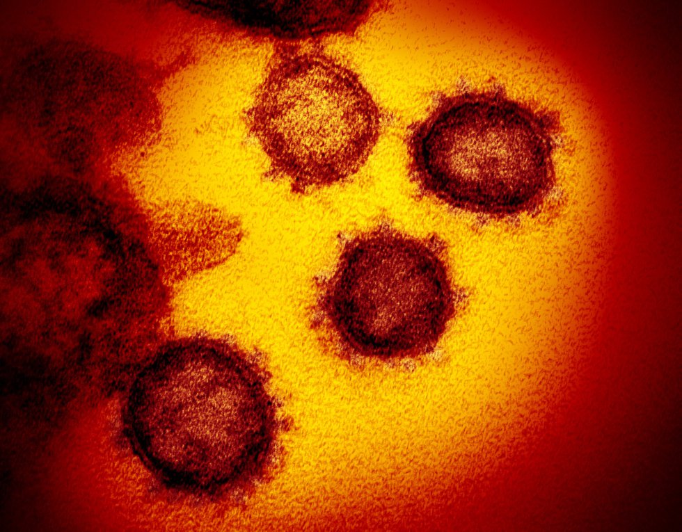 Esta imagen de microscopio electrónico del Instituto estadounidense de Alergia y Enfermedades Infecciosas (NIAID) muestra el SARS-CoV-2, también conocido como 2019-nCoV, el virus que causa COVID-19, aislado de un paciente de EE.UU., que emerge de la superficie de células cultivadas en laboratorio, en Hamilton / Montana (Estados Unidos de América), a 13 de febrero de 2020.
CORONAVIRUS;COVID-19;ESTADO DE ALARMA;PANDEMIA;LABORATORIO;NIAID;
NIAID-RML (Foto de ARCHIVO)
13/02/2020 Esta imagen de microscopio electrónico del Instituto estadounidense de Alergia y Enfermedades Infecciosas (NIAID) muestra el SARS-CoV-2, también conocido como 2019-nCoV, el virus que causa COVID-19, aislado de un paciente de EE.UU., que emerge de la superficie de células cultivadas en laboratorio, en Hamilton / Montana (Estados Unidos de América), a 13 de febrero de 2020.
CORONAVIRUS;COVID-19;ESTADO DE ALARMA;PANDEMIA;LABORATORIO;NIAID;
NIAID-RML (Foto de ARCHIVO)
13/02/2020