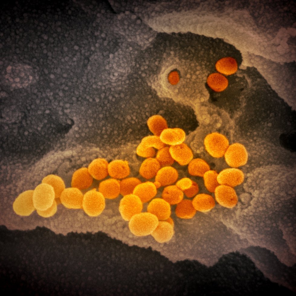 Esta imagen de microscopio electrónico del Instituto estadounidense de Alergia y Enfermedades Infecciosas (NIAID) muestra el SARS-CoV-2, en color naranja, también conocido como 2019-nCoV, el virus que causa COVID-19, aislado de un paciente de EE.UU., que emerge de la superficie de las células, en color gris, cultivadas en laboratorio, en Hamilton / Montana (Estados Unidos de América), a 13 de febrero de 2020.
CORONAVIRUS;COVID-19;ESTADO DE ALARMA;PANDEMIA;LABORATORIO;NIAID;
NIAID-RML (Foto de ARCHIVO)
13/02/2020 Esta imagen de microscopio electrónico del Instituto estadounidense de Alergia y Enfermedades Infecciosas (NIAID) muestra el SARS-CoV-2, en color naranja, también conocido como 2019-nCoV, el virus que causa COVID-19, aislado de un paciente de EE.UU., que emerge de la superficie de las células, en color gris, cultivadas en laboratorio, en Hamilton / Montana (Estados Unidos de América), a 13 de febrero de 2020.
CORONAVIRUS;COVID-19;ESTADO DE ALARMA;PANDEMIA;LABORATORIO;NIAID;
NIAID-RML (Foto de ARCHIVO)
13/02/2020