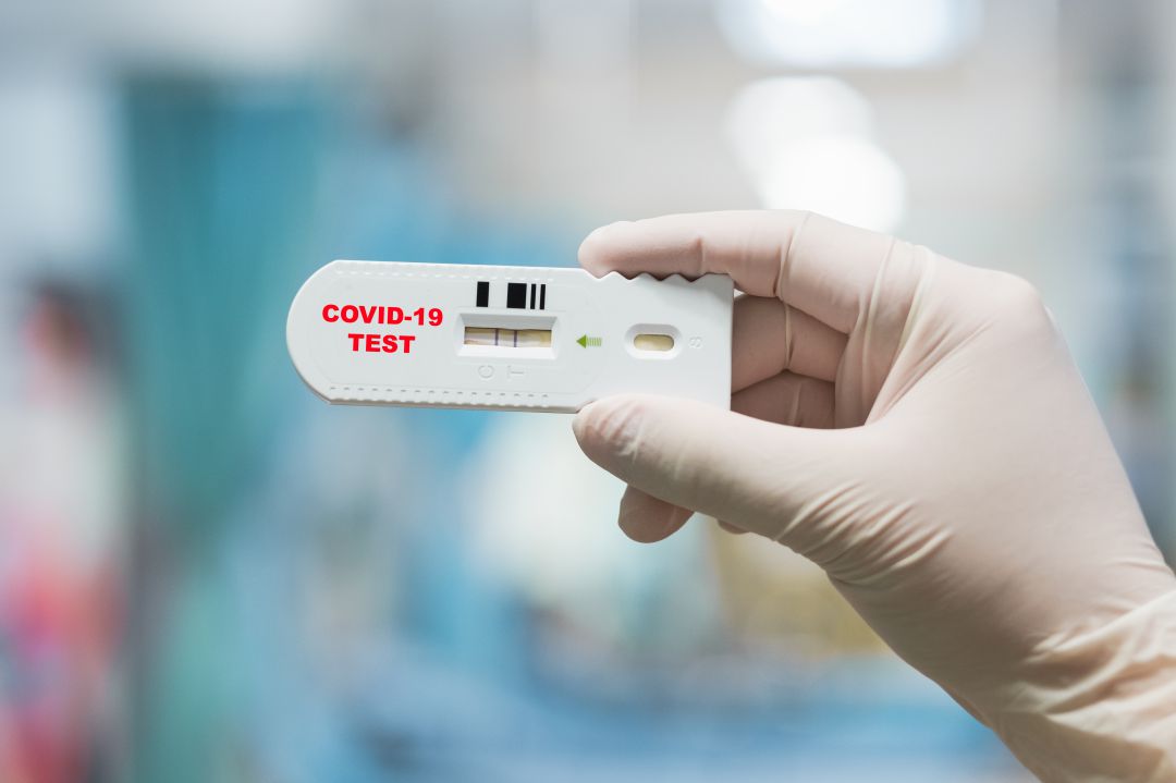 Primary care doctors warn about the false security that antigen tests can give |  Radio Coruña |  Today for Today A Coruña