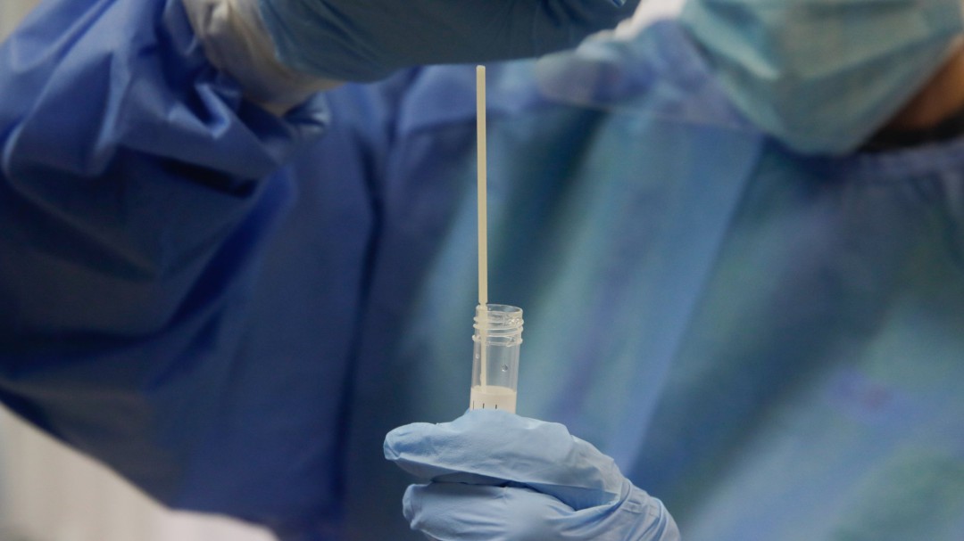 Seis comunidades autónomas detectan casos la cepa británica de la COVID