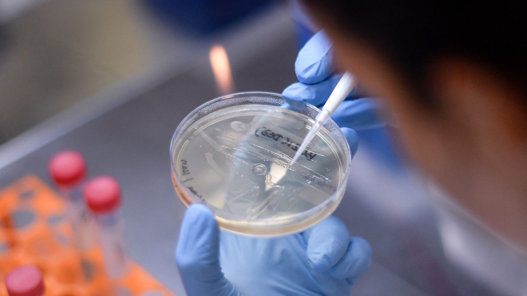 Investigadores españoles demuestran que no todo el colesterol bueno es saludable