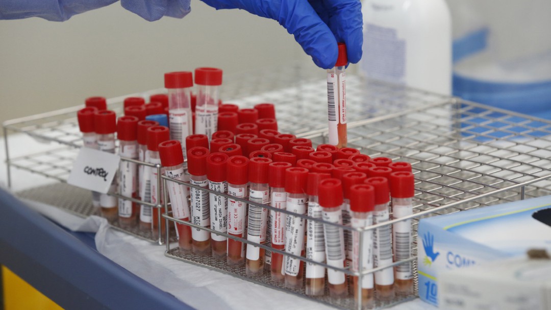 Castilla y León registra 241 nuevos casos y ocho fallecidos