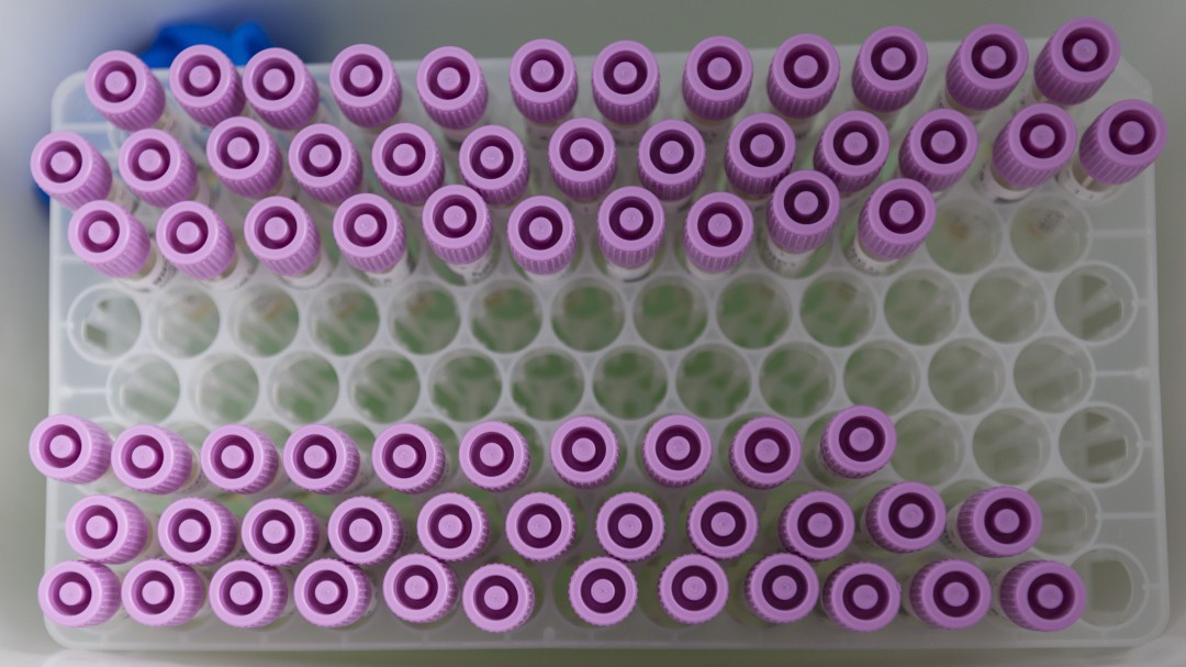 Asturias suma 135 contagios por COVID-19 y se acerca a los 42.000 inmunizados