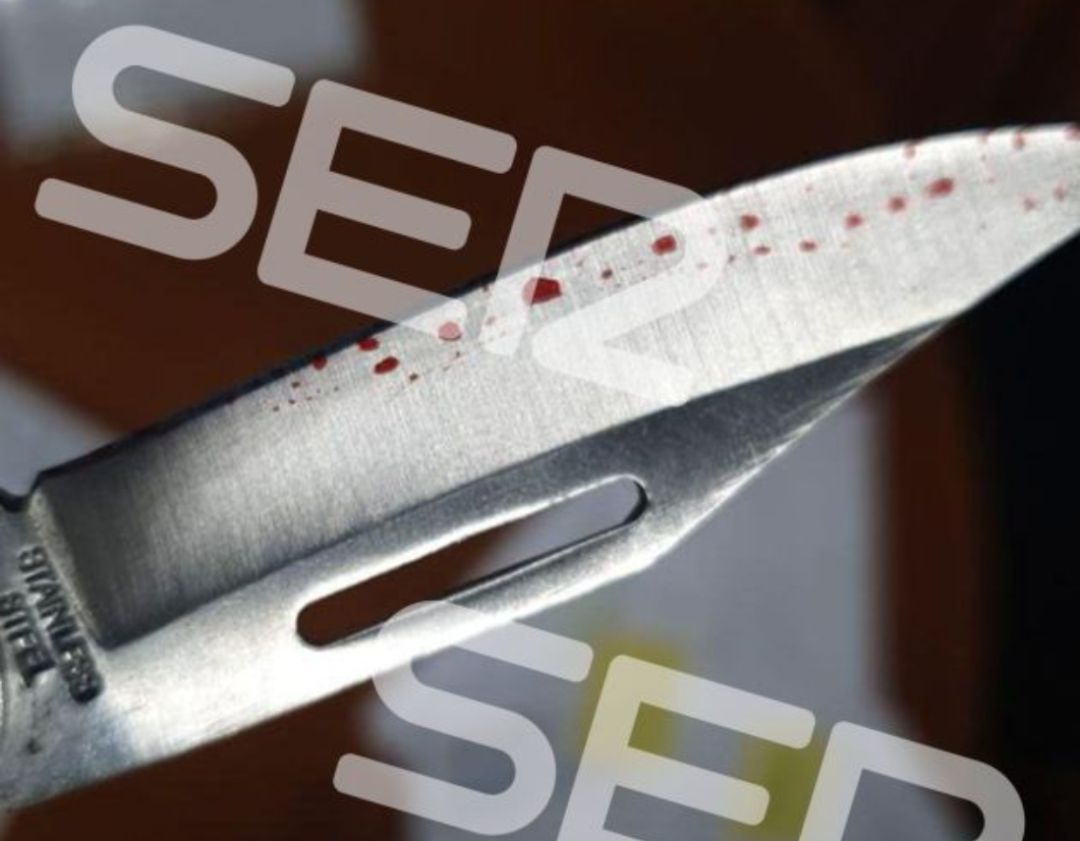 Detalle del cuchillo "aparentemente ensangrentado" que ha llegado a Reyes Maroto