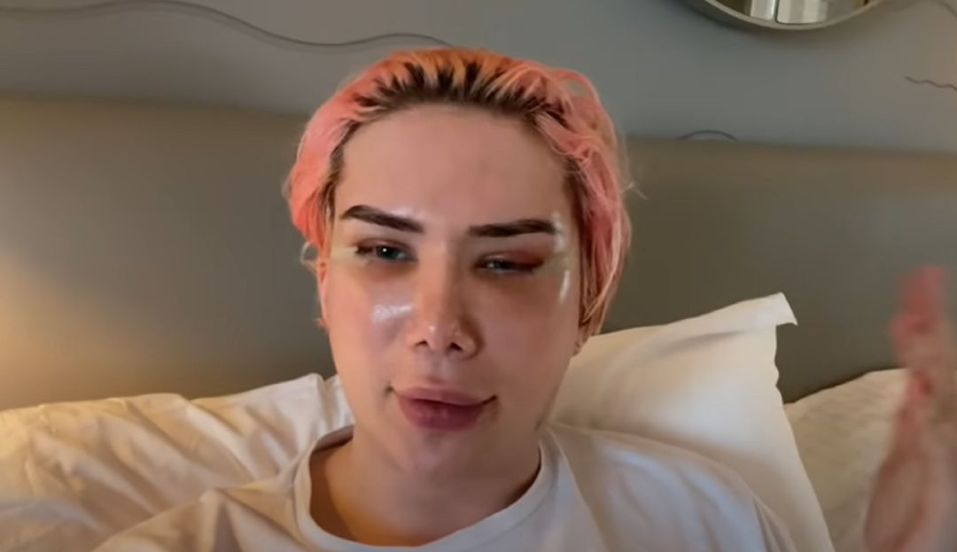 Oli London, el youtuber británico que se sometió a 18 cirugías para